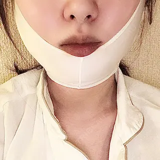 1日目の経過画像（1枚目）