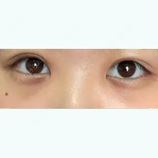 7日目の経過画像（1枚目）