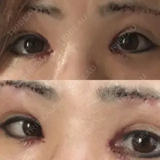1日目の経過画像（1枚目）