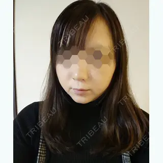 6日目の経過画像（1枚目）