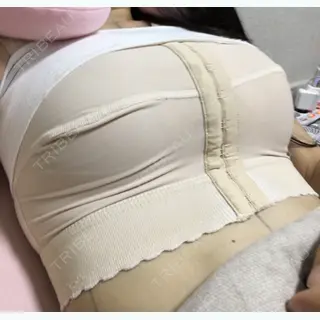 0日目の経過画像（3枚目）