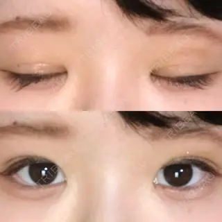6日目の経過画像（1枚目）