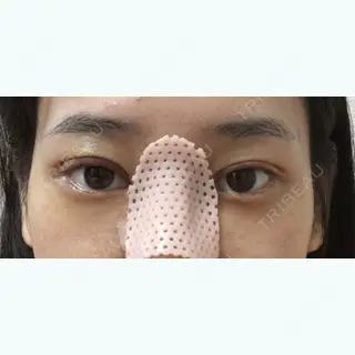 3日目の経過画像（1枚目）