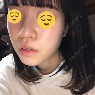 10日目の経過画像（1枚目）