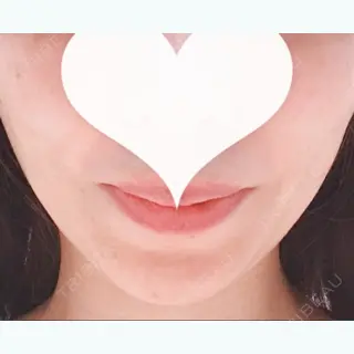 10日目の経過画像（2枚目）