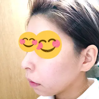 19日目の経過画像（1枚目）