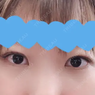 9日目の経過画像（1枚目）