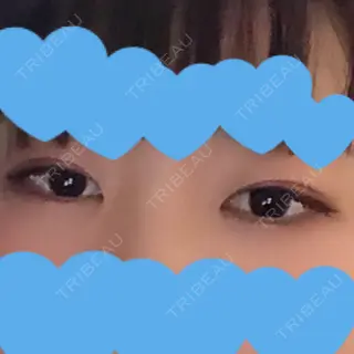 161日目の経過画像（1枚目）