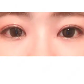 27日目の経過画像（3枚目）