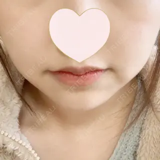 8日目の経過画像（2枚目）