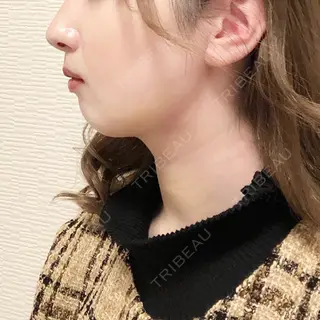7日目の経過画像（2枚目）