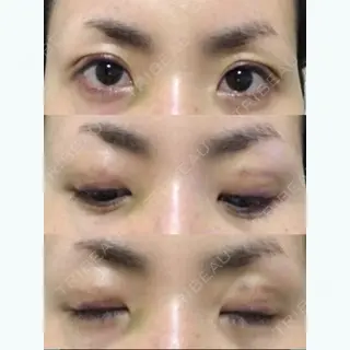 10日目の経過画像（1枚目）