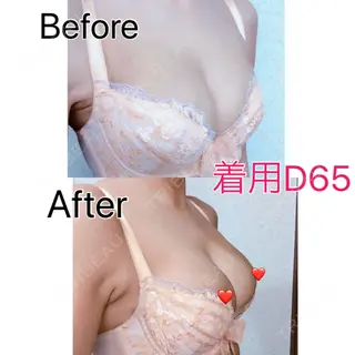 23日目の経過画像（2枚目）