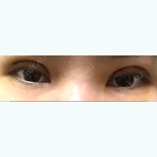 3日目の経過画像（1枚目）