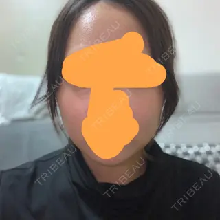 3日目の経過画像（1枚目）