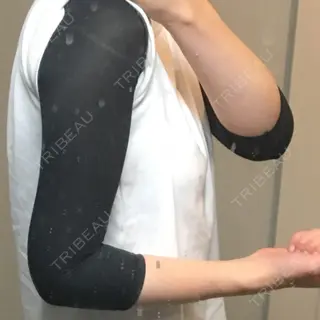 0日目の経過画像（3枚目）