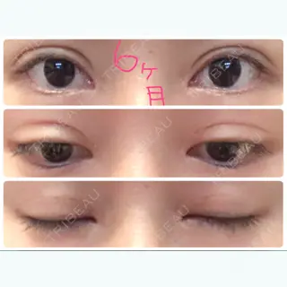 186日目の経過画像（1枚目）