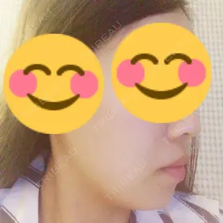 2日目の経過画像（3枚目）