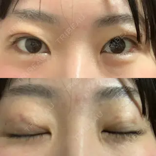 3日目の経過画像（1枚目）
