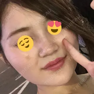 1日目の経過画像（3枚目）