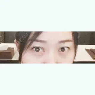 91日目の経過画像（1枚目）