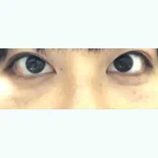 7日目の経過画像（1枚目）