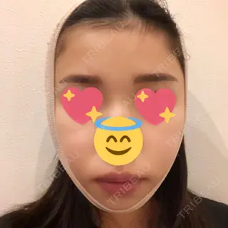 1日目の経過画像（1枚目）