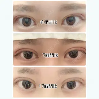 1日目の経過画像（1枚目）