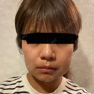 3日目の経過画像（1枚目）