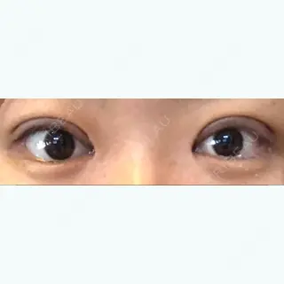 10日目の経過画像（1枚目）