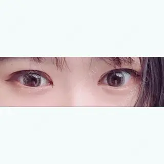 40日目の経過画像（1枚目）