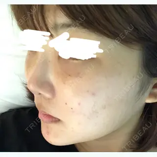 2日目の経過画像（2枚目）