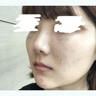 3日目の経過画像（3枚目）