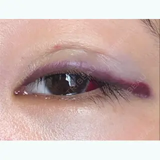 1日目の経過画像（2枚目）