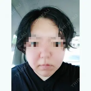 0日目の経過画像（1枚目）