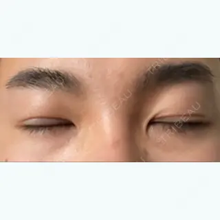 2日目の経過画像（2枚目）