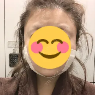 0日目の経過画像（1枚目）