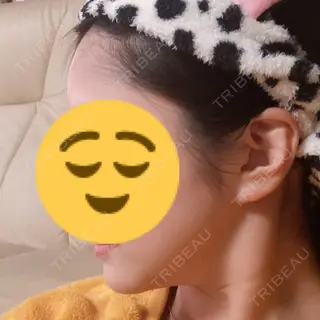137日目の経過画像（3枚目）