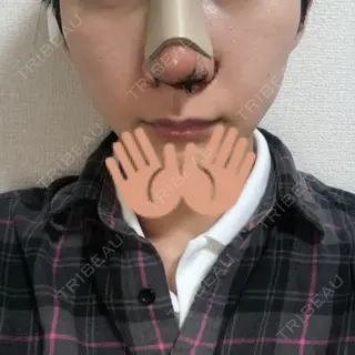 2日目の経過画像（1枚目）