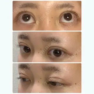7日目の経過画像（2枚目）