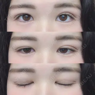 3日目の経過画像（1枚目）