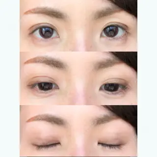 17日目の経過画像（3枚目）