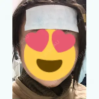 3日目の経過画像（1枚目）