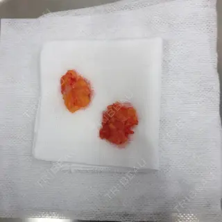 0日目の経過画像（1枚目）