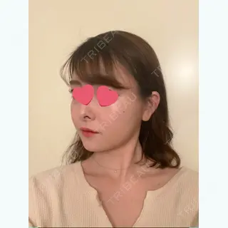 91日目の経過画像（2枚目）