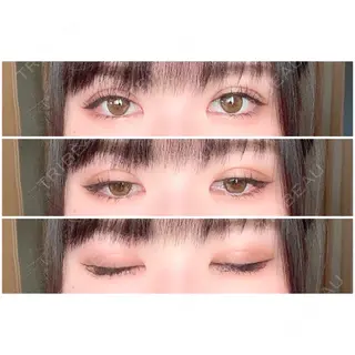 3日目の経過画像（2枚目）