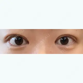 183日目の経過画像（2枚目）