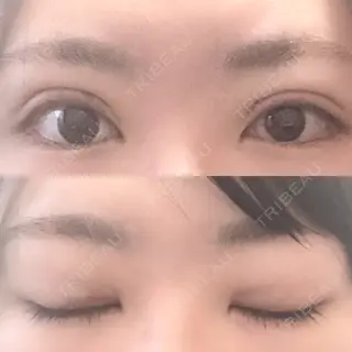 6日目の経過画像（1枚目）