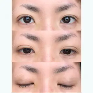 18日目の経過画像（3枚目）
