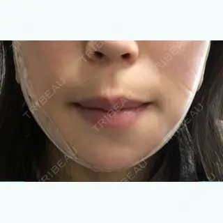 1日目の経過画像（1枚目）